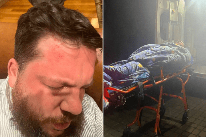 Former Alexei Navalny aide brutally attacked with hammer, blames ‘Putin’s henchmen’