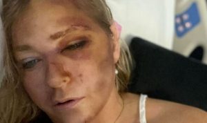 Epstein victim who claimed Prince Andrew abuse says ‘4 days to live’ in shocking post