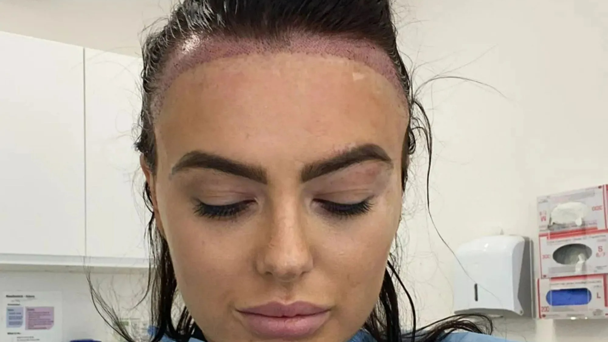 The celeb hair transplants that are SO good we forgot they’d had it, including Joe Swash, Steph Davies & Wayne Rooney