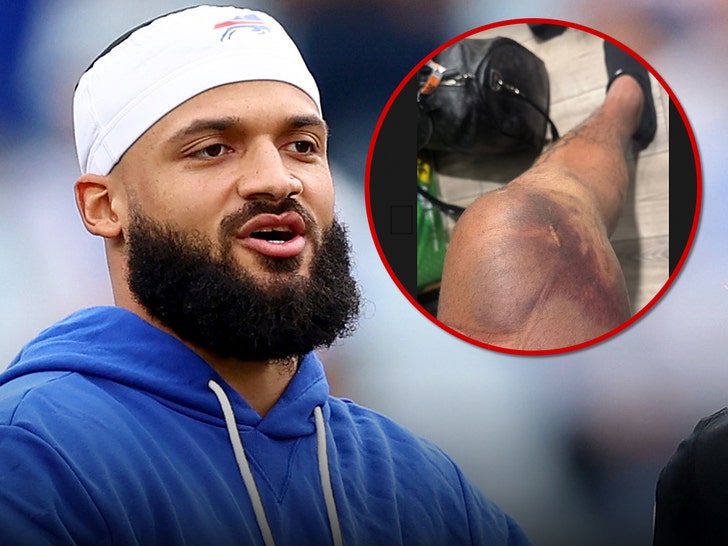 Buffalo Bills WR Gabe Davis Shows Off Busted Knee Day After Gruesome Injury