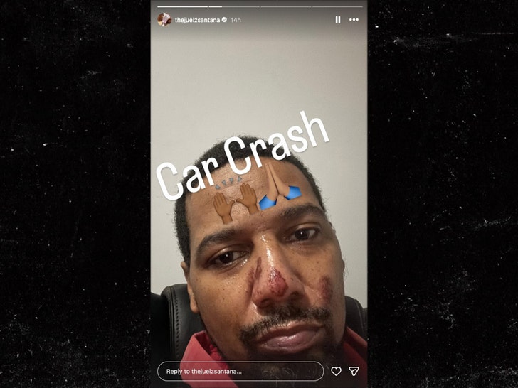 Juelz Santana Posts Facial Scrapes Selfie After Scary Car Accident