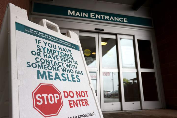 Measles alert urges countries to vaccinate more, including Canada