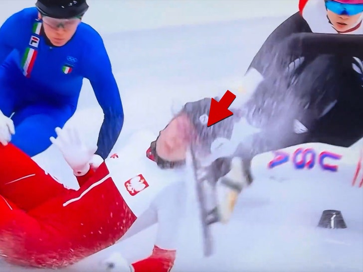 Olympic Skater Takes Blade to Face During Race at Winter Games, Gruesome Injury