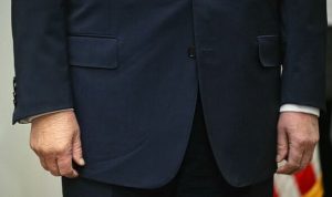 Trump’s bruised hand now ‘swollen’ as health fears soar