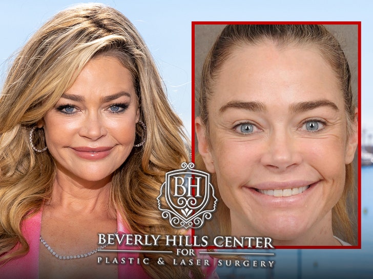 Denise Richards’ Before-and-After Pics Are Giving Her Surgeon’s Business a Lift