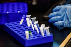 Hantavirus bombshell as 2 vials of deadly rat virus vanished from Australian lab in 2024