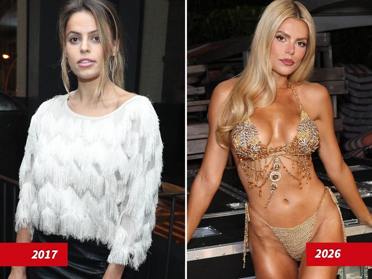 Brooks Nader Then And Now — Good Genes or Good Docs?!