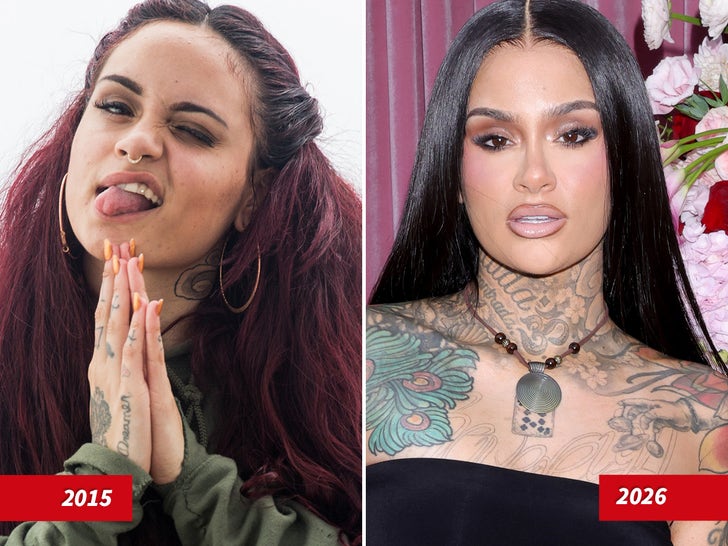 Kehlani Then And Now — Good Genes or Good Docs?!