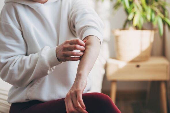 Victorian-era skin disease rips through UK – 3 key symptoms