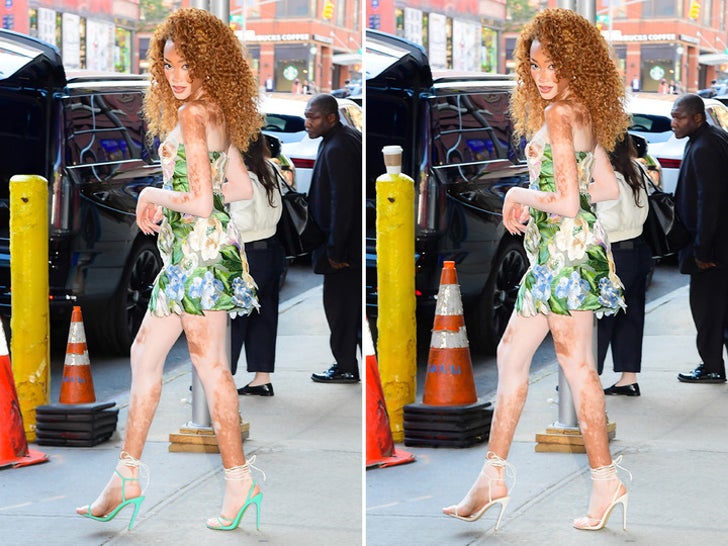 Winnie Harlow Turns Head In NYC What’s The Big Frigin’ Difference?!