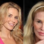 Brandi Glanville ‘scared to death’ ahead of new corrective surgery on her face