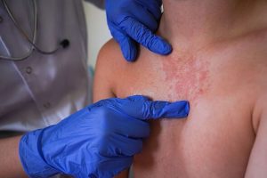 Horror Victorian disease outbreak forces closure of hospital ward – spreads quickly